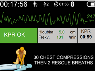 DefiSign Pocket Plus Option Affichage ECG  - 11527