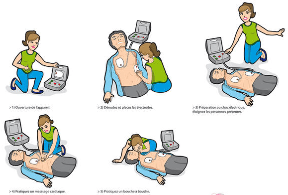 Réanimation et utilisation d'un défibrillateur externe automatique - Mensura