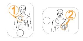 CU-MEDICAL i-PAD SP1 électrodes