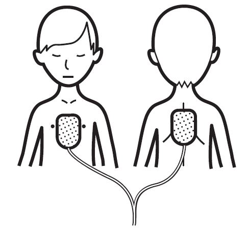 Defibtech Lifeline View électrodes